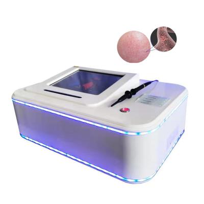 China Get Rid of Spider 30mhz Red Vascular High Frequency Vein Laser Best Price Nets Blood Removal Vascular Machine for sale