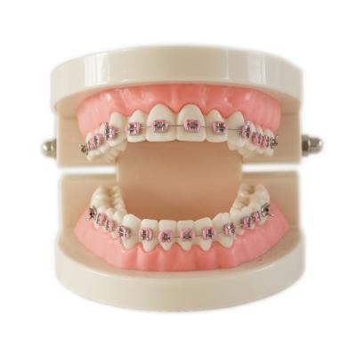 China Dental Teeth Teaching Study Model Set Orthodontic Model with Metal Bracket /dental bracket Standard model of dentures for sale