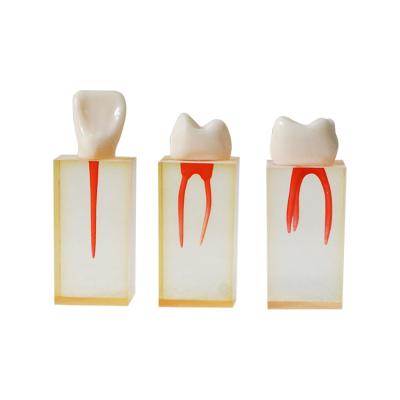 China Clinic Dental Product Model Decoration Dental Endodontic Dental Root Canal Model Root Canal Teeth For Students Practice en venta