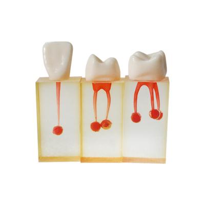 China Medical Students Dental Canal Teeth Practice Model 3PCS Dental Teaching Products Transparent Teeth Root Model for sale