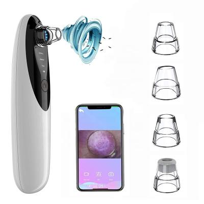 China Acne Treatment HD Camera Pore Blackhead Remover Blackhead Remover Vacuum Cleaner Vacuum With Camera for sale