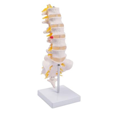 China Lumbar Vertebrae Spinal Column Anatomical Skeleton Model For Medical Demonstration Life Size for sale