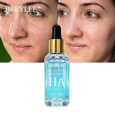 China Skin Revitalizer Hyaluronic Acid Whitening Glow Serum Organic Vitamin C Skin Care Kojic Acid Serum for sale