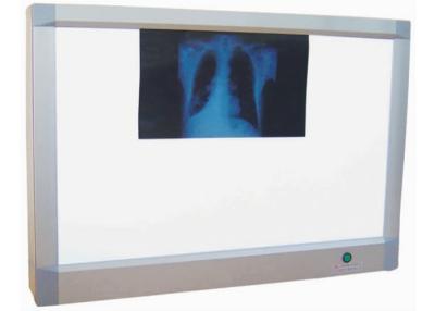 China Aluminum Alloy X Ray Viewer for Two Films Medical X Ray Machine for sale