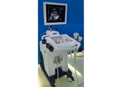 China High Resolution 15 Inch LED Fully Digital Trolley Ultrasound Scanner for sale