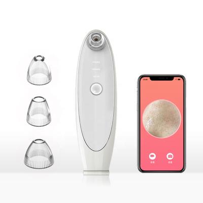 China Black Head Removal Portable 3 in 1 APP Control Visual Radio USB Rechargeable Facial Nose Peeks Remover Vacuum Blackhead Remover for sale