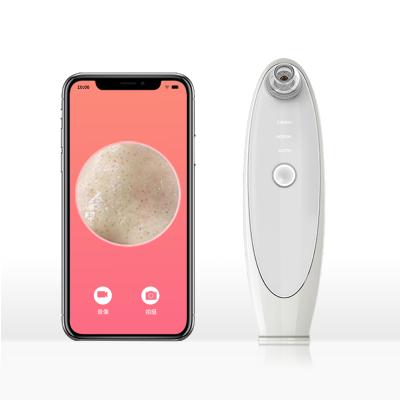 China Black Head Removal Custom Logo Electric Blackhead Remover With Wireless WiFi Camera Observation Skin Care Tools Blackhead Remover for sale