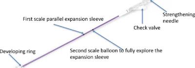 China Veiligheidsprestaties Kyphoplasty Kit Vertebral Expansion Balloon Kit Gemakkelijk te werken Te koop