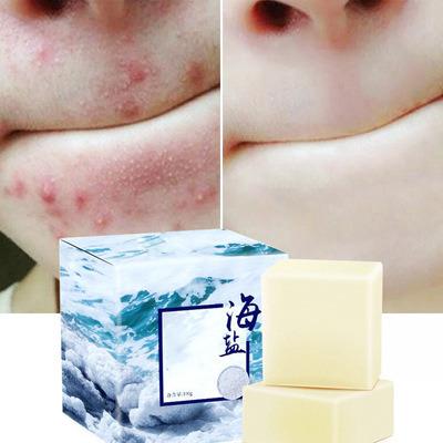 China Private Label Oil Sea Salt Sea Salt Soap Goat Milk Face Skin Remover Scar Blackhead Remover Whitening Base Cleansing Hand Made Soap for sale