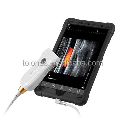 China LHMX5 China Cheapest Medical Ultrasound Scanner USB Plastic Portable Probe Equipment Mobile USB Ultrasound Probe for sale