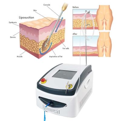 China Skin Tightening Professional Vascular Laser Physiotherapy Equipments Nail Treatment Liposuction Machine Vaser Diode Fungus Laser for sale