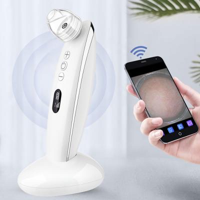 China Blackhead Vacuum Derma Portable Electric Eye Suction Nose Facial Blackhead Remover for sale