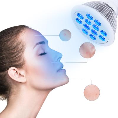 China Portable Blood Vessel Removal RD30 LED Blue Light Therapy For Neonatal Physical Jaundice Red 660nm Light Anti Aging Therapy for sale