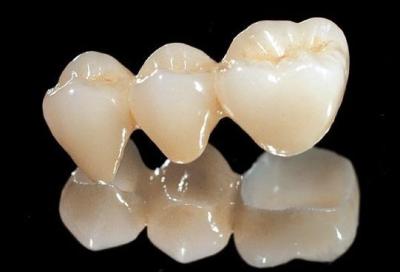 China Toda a coroa dental da zircônia cerâmica à venda