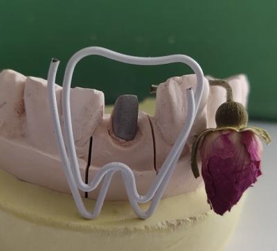 중국 금속 치아의 포스트와 endodontic 처리 뒤에 있는 핵심 판매용