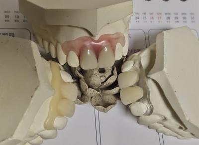 China Dentadura invisível macia confortável do ajuste ISO13485 RPD à venda