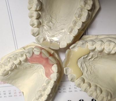 China Dentadura invisível livre do metal da resina para o paciente alérgico à venda