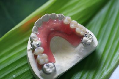 China Dentadura invisível flexível parcial para os dentes anteriores à venda