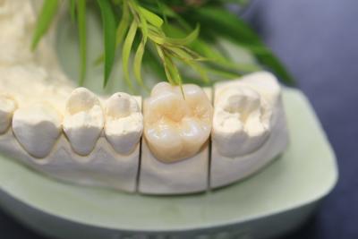 China Coroa dental da zircônia monolítica para os dentes traseiros dos molares à venda