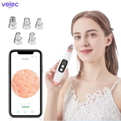 China Smart Visual Remover Kit Suction Vacuum With Camera Mini Blackhead Removal Nose Blackhead Remover Skin Care Blackhead Deep Pore Remover for sale