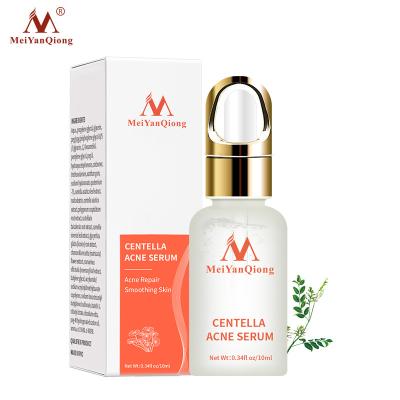 China Whitening Centella Asiatica Acne Removing Serum face Serum liquid Moisturizing Anti Wrinkle Shrink Pore Control Oil Whiten Skin 10ml for sale