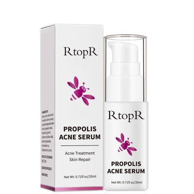 China RtopR Propolis Repair Acne Serum Acne Brightening Scar Whitening Spots Serum Cleansing Shrink Pores Remove Acne Treatment Oil Control for sale