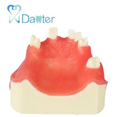 China Fantastic Upper Dental Model Hospital Clinic University Quality Dental Implant Practice Model for Dental Students for sale