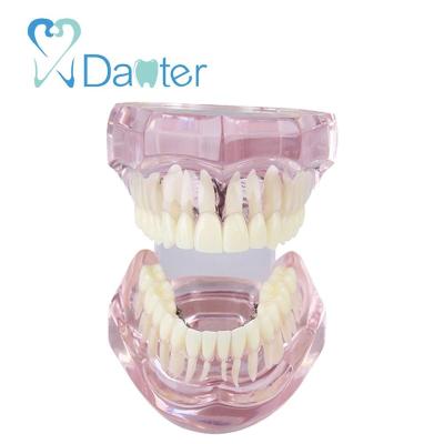 China Hospital Clinic University Factory Price Dental Orthodontic Model With Lingual Bracket For Student Dental Practice for sale