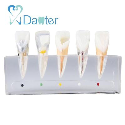 China Incisor Hospital Clinic University Root Canal Dental Model Endodontic Treatment Model for sale