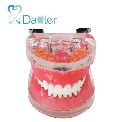 China Hospital Clinic University Dental Periodontal Model With Replacement Gums Dental Teaching Model for sale