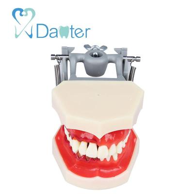 China Wholesale Hospital Clinic University Pathologies Disease Model For Dental Treatment Demonstration for sale