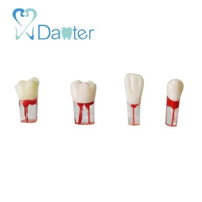 China Detailed Anatomy Structures Dental Endo Root Canal Teeth Model Use For Endodotics Practice for sale