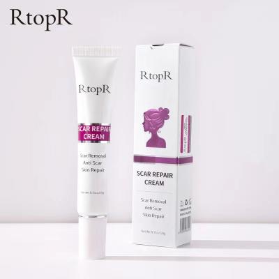 China Yanmei RtopR Moisturizer Remove Broken Collagen Repair Anti Scar Skin Treatment Scar Elastic Fibers for sale