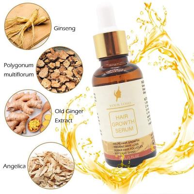 China Ginger Extract Organic Essence Thickening Liquid Essence Anti Hair Loss Hair Loss Treatment YANMEI Private Label Hair Loss Volumizing Hair Serum for sale