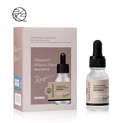 China Dark Circles Wholesale Natural 15ml Oligopeptide Anti Acne Serum Acne Prints Removal Serum for sale