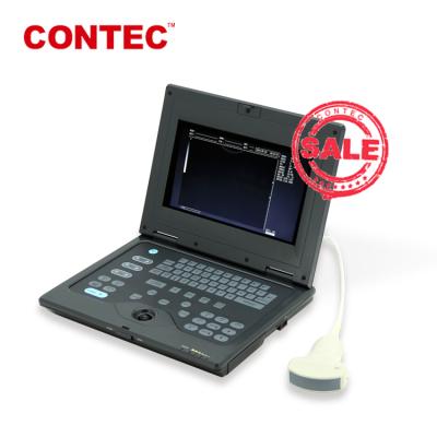 China Laptop Plastic Ultrasound Scanner Diagnostic System, CMS600P Portable Ultrasound +Convex Probe, Notebook Style Medical Ultrasound for sale