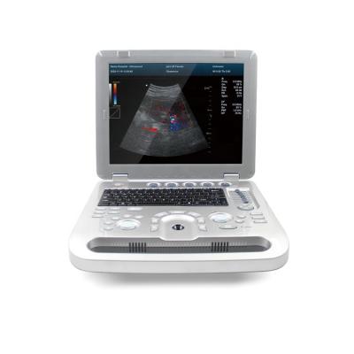 China Plastic Factory CONTEC Ultrasound Machine Portable Ultrasound System Color Ultrasonic Doppler Diagnostic Device for sale