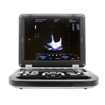 China CONTEC CMS1700C Plastic Cheap Portable Medical Ultrasound Scanner for sale