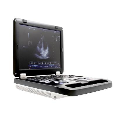 China CONTEC CMS1700C Plastic Portable Ultrasound Machine Color Doppler Ultrasound Medical Instruments for sale