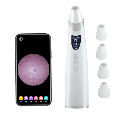 China Black Main Removal Battery WIFI Connect Camera Vacuum Beauty Equipment Blackhead Remover Obvious Beauty Machine for sale