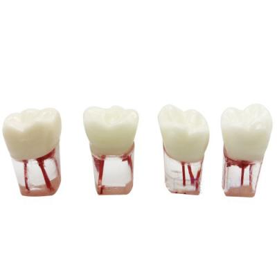 China School.hosptical medical dental root canal model for sale