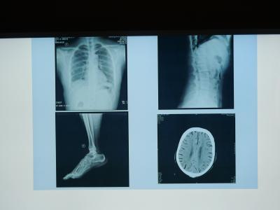 Chine Film d'imagerie médicale de Konida X Ray imperméable pour l'imprimante d'Agfa à vendre