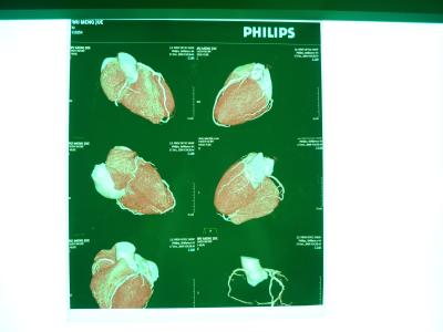 China Medical Digital X Ray Dry Film , Dt2b / Dt1b Agfa Medical Dry Imaging Film for sale