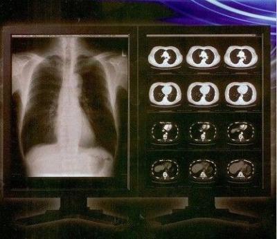 China Heller klarer Film Digital-X Ray, Konida medizinischer Laser-Transparenz-Film zu verkaufen