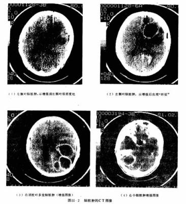 China Polegada médica do papel 8×10 do filme seco transparente da impressora a laser X Ray à venda