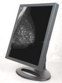 China Medical Grade Monitor Displays for sale