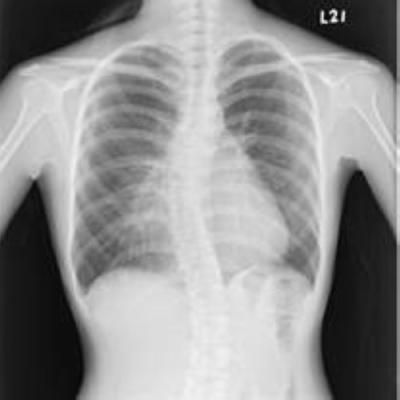 China Tragbare weiße niedrige medizinische Filme X Ray, Röntgenstrahl-Papier-Film der medizinischen Bildgebung zu verkaufen