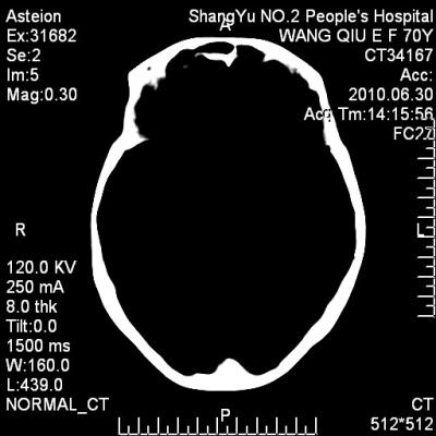 China Konida Digital X-ray Medical Dry Thermal Printer Film KND-A, KND-F for sale