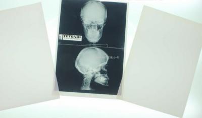 China Konida el 10in el x 12in X Ray Medical Imaging en venta