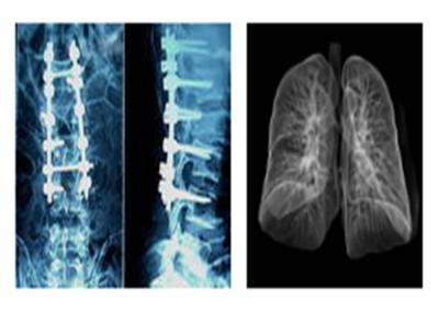 중국 예리한 방사선 사진 의학 엑스레이 영화, Ct Digital Dry Imaging Mri 박사 영화 판매용